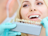 What to Know Before Getting a Dental Implant Summerlin